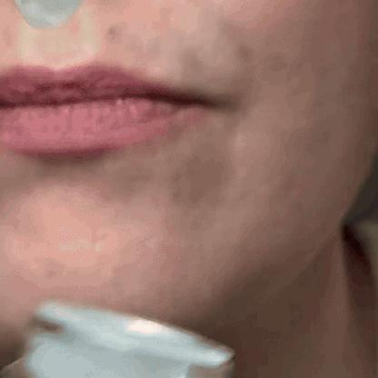 Renovo Peel Shot - Renewal Rice Exfoliating Ampoule